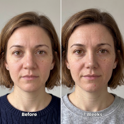 Nuvelle Sculpt™